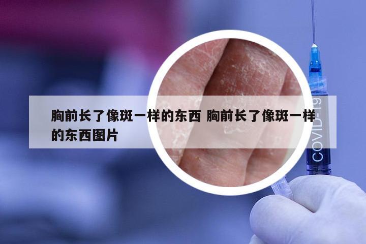 胸前长了像斑一样的东西 胸前长了像斑一样的东西图片