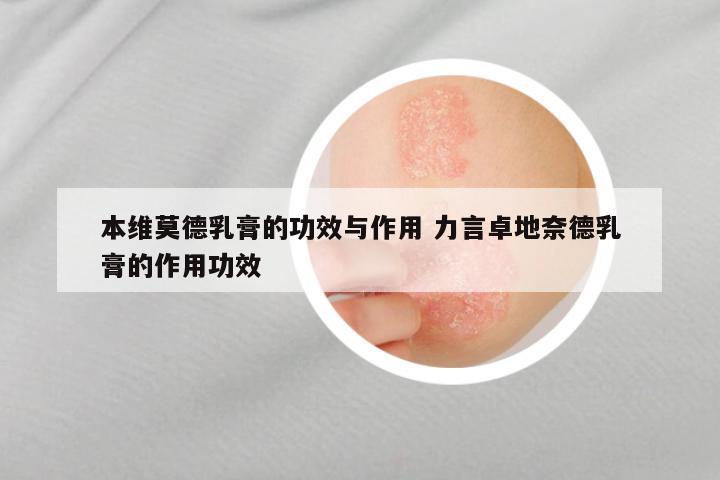 本维莫德乳膏的功效与作用 力言卓地奈德乳膏的作用功效