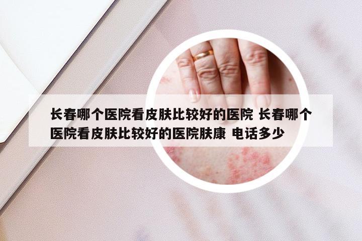 长春哪个医院看皮肤比较好的医院 长春哪个医院看皮肤比较好的医院肤康 电话多少