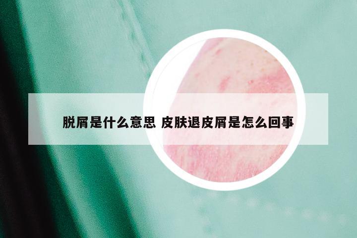 脱屑是什么意思 皮肤退皮屑是怎么回事