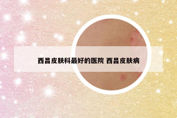 西昌皮肤科最好的医院 西昌皮肤病