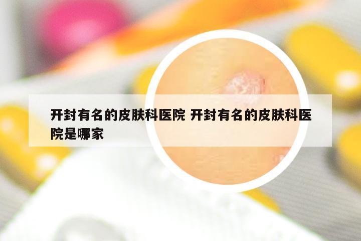 开封有名的皮肤科医院 开封有名的皮肤科医院是哪家