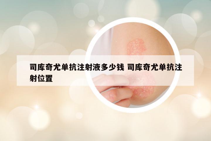司库奇尤单抗注射液多少钱 司库奇尤单抗注射位置