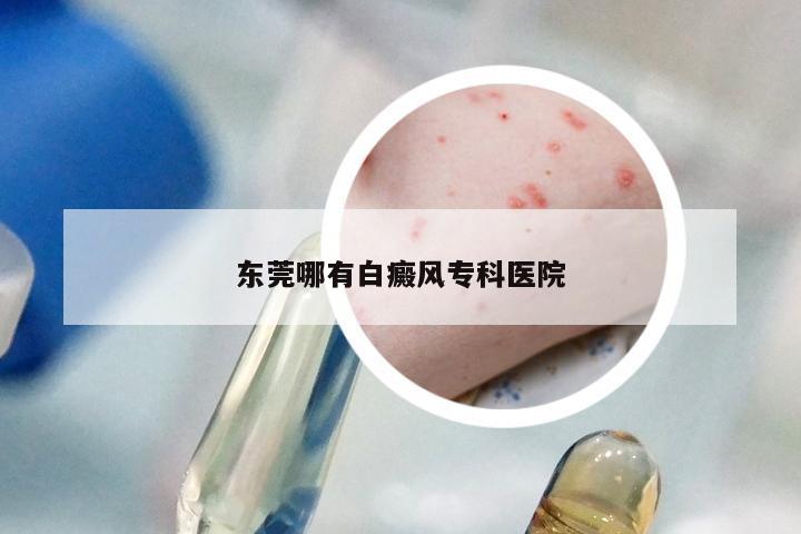 东莞哪有白癜风专科医院