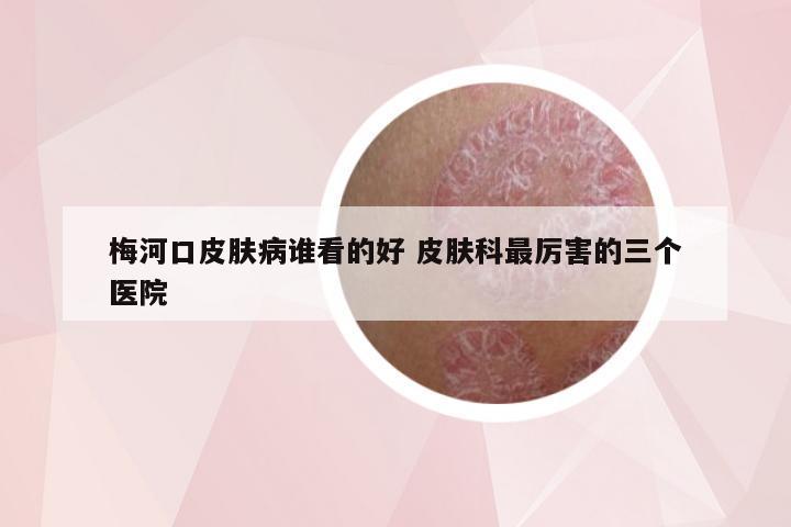 梅河口皮肤病谁看的好 皮肤科最厉害的三个医院
