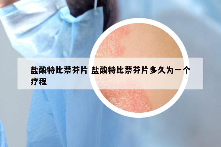 盐酸特比萘芬片 盐酸特比萘芬片多久为一个疗程