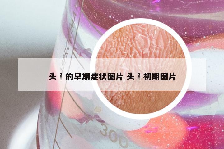 头廯的早期症状图片 头廯初期图片