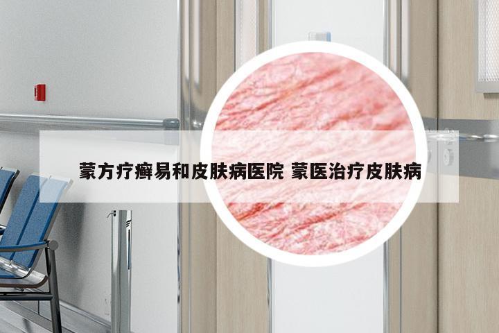 蒙方疗癣易和皮肤病医院 蒙医治疗皮肤病