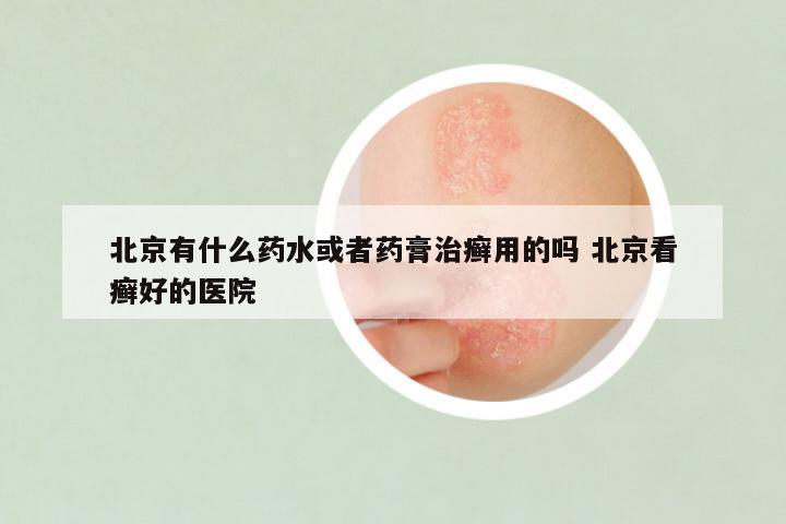 北京有什么药水或者药膏治癣用的吗 北京看癣好的医院