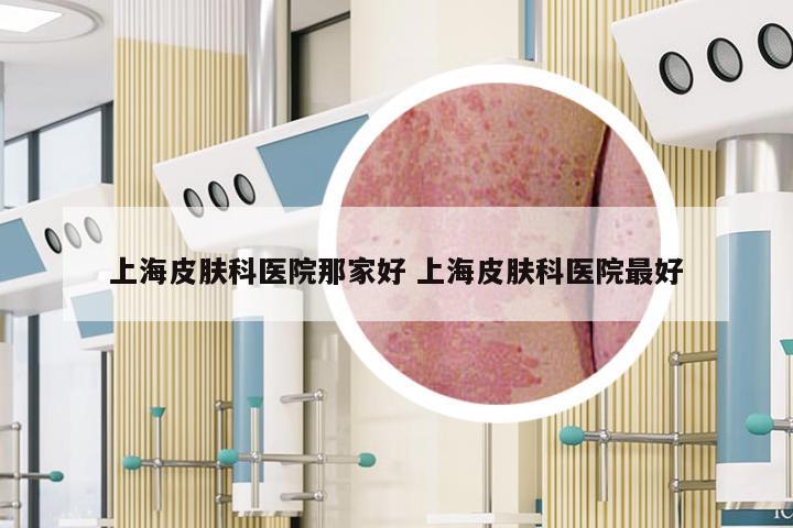 上海皮肤科医院那家好 上海皮肤科医院最好