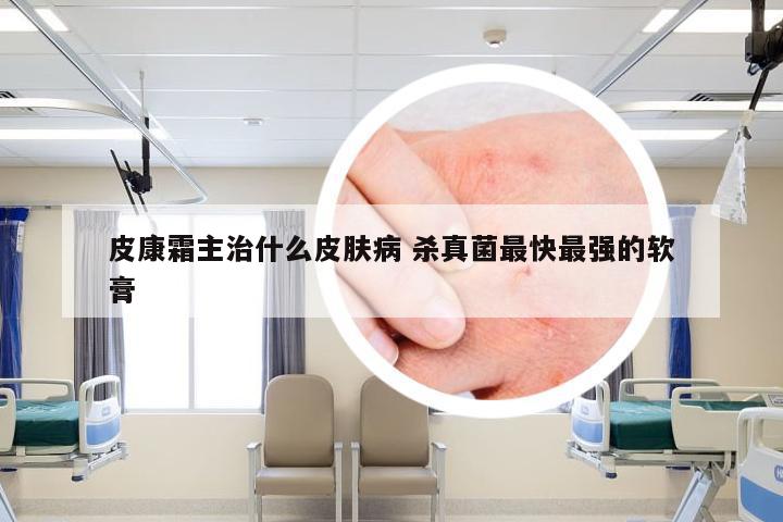 皮康霜主治什么皮肤病 杀真菌最快最强的软膏