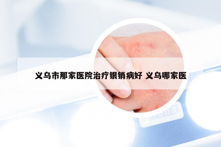 义乌市那家医院治疗银销病好 义乌哪家医