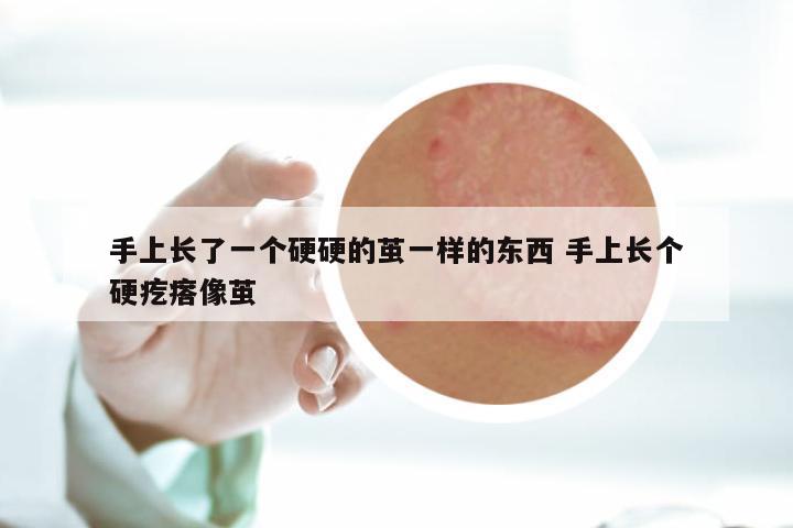 手上长了一个硬硬的茧一样的东西 手上长个硬疙瘩像茧