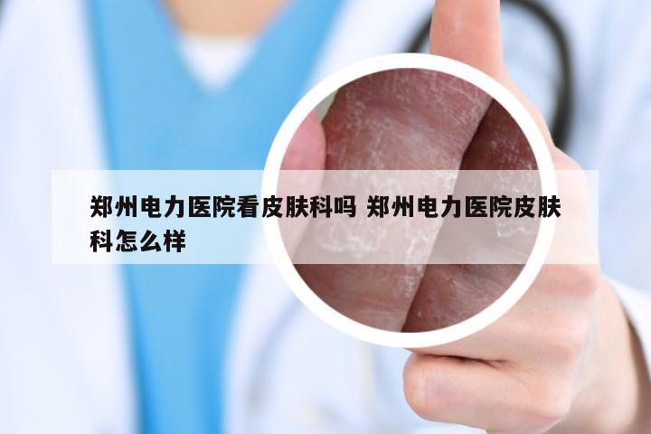 郑州电力医院看皮肤科吗 郑州电力医院皮肤科怎么样