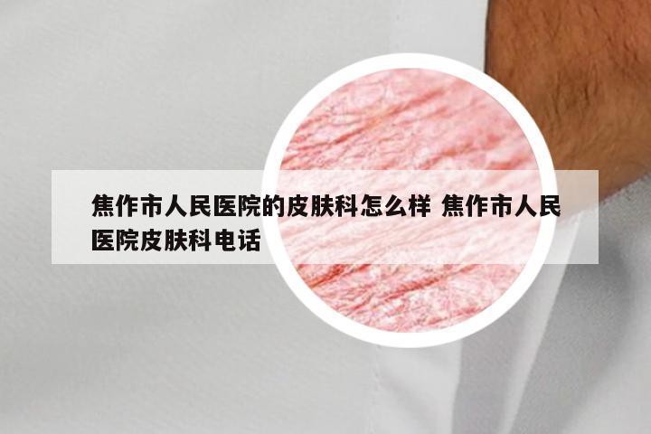 焦作市人民医院的皮肤科怎么样 焦作市人民医院皮肤科电话