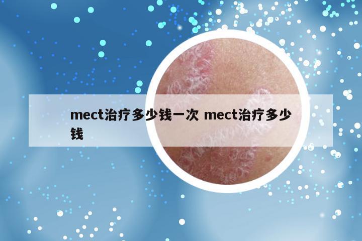mect治疗多少钱一次 mect治疗多少钱