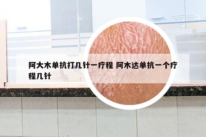 阿大木单抗打几针一疗程 阿木达单抗一个疗程几针