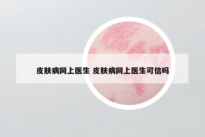 皮肤病网上医生 皮肤病网上医生可信吗