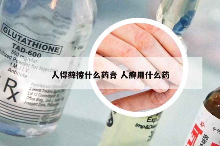 人得藓擦什么药膏 人癣用什么药