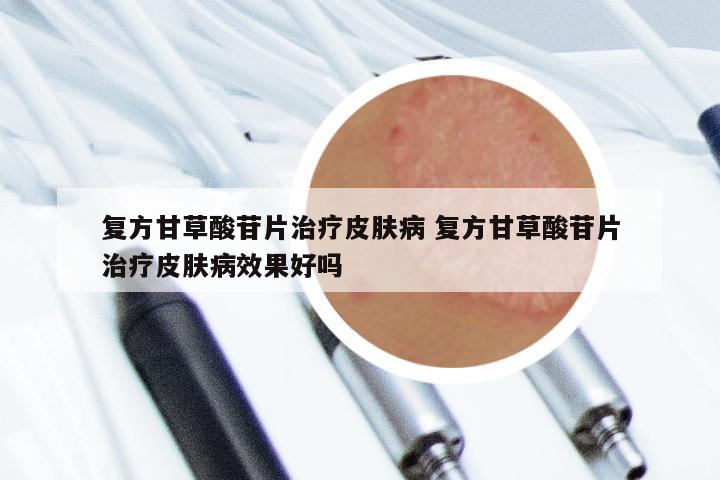 复方甘草酸苷片治疗皮肤病 复方甘草酸苷片治疗皮肤病效果好吗