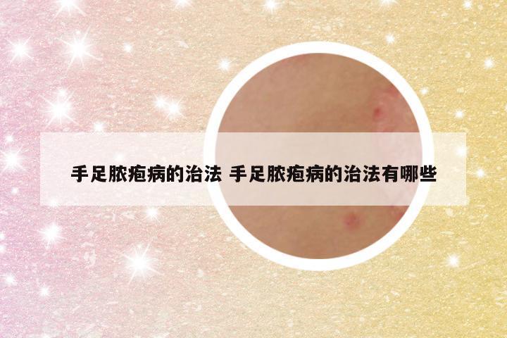 手足脓疱病的治法 手足脓疱病的治法有哪些