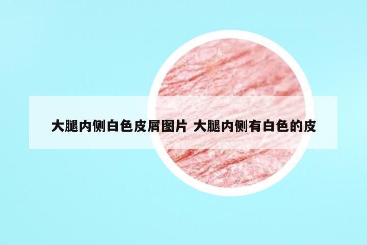 大腿内侧白色皮屑图片 大腿内侧有白色的皮