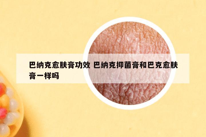 巴纳克愈肤膏功效 巴纳克抑菌膏和巴克愈肤膏一样吗
