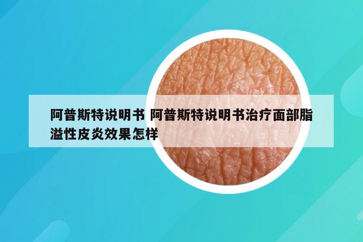 阿普斯特说明书 阿普斯特说明书治疗面部脂溢性皮炎效果怎样