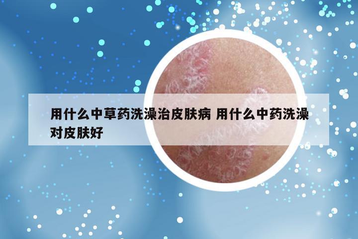 用什么中草药洗澡治皮肤病 用什么中药洗澡对皮肤好