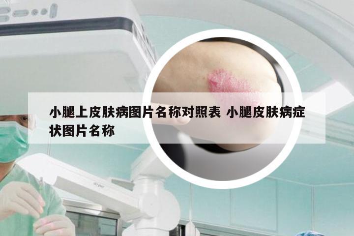 小腿上皮肤病图片名称对照表 小腿皮肤病症状图片名称