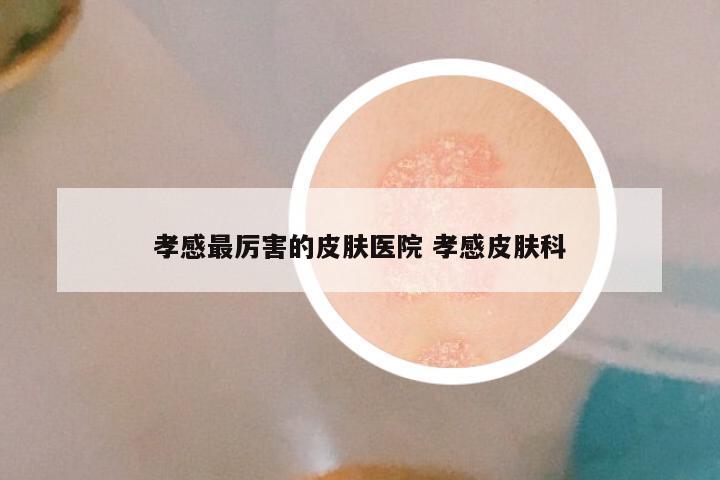 孝感最厉害的皮肤医院 孝感皮肤科