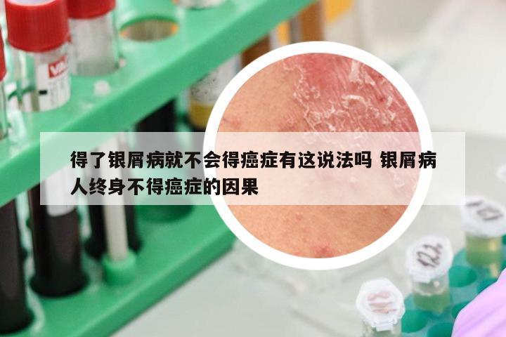 得了银屑病就不会得癌症有这说法吗 银屑病人终身不得癌症的因果