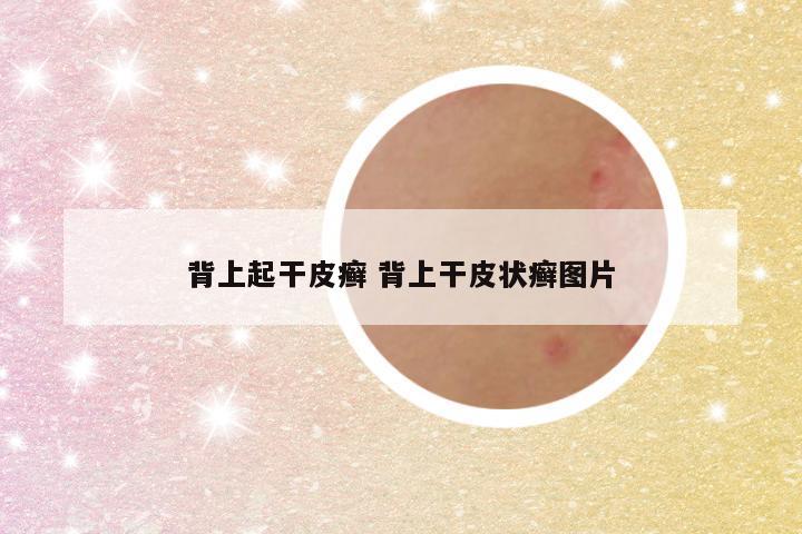 背上起干皮癣 背上干皮状癣图片