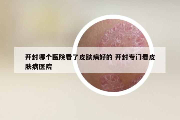 开封哪个医院看了皮肤病好的 开封专门看皮肤病医院