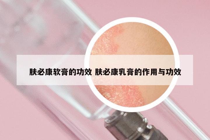 肤必康软膏的功效 肤必康乳膏的作用与功效