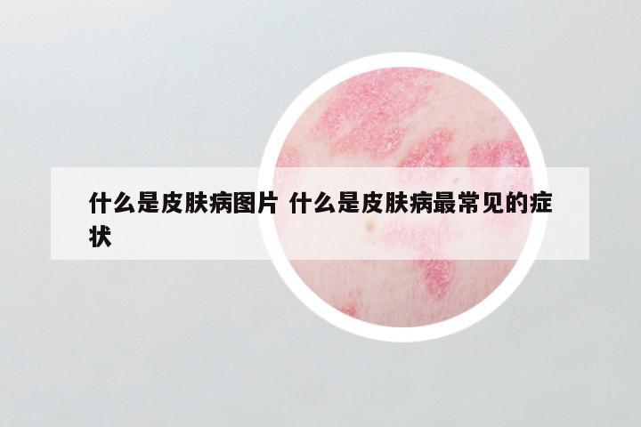 什么是皮肤病图片 什么是皮肤病最常见的症状