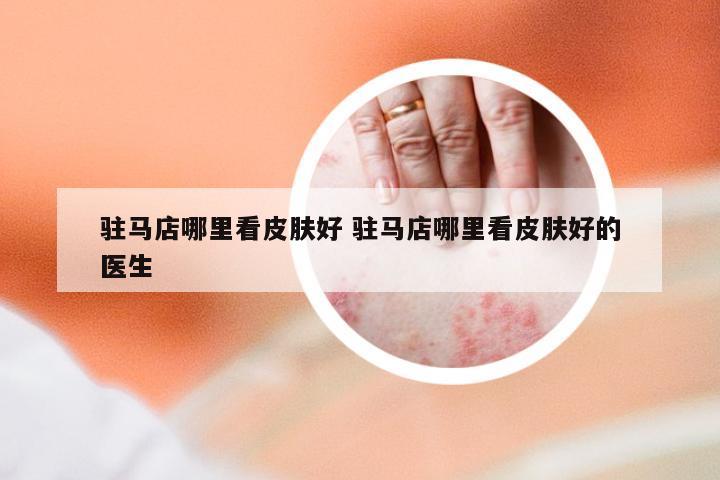 驻马店哪里看皮肤好 驻马店哪里看皮肤好的医生