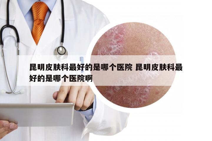 昆明皮肤科最好的是哪个医院 昆明皮肤科最好的是哪个医院啊
