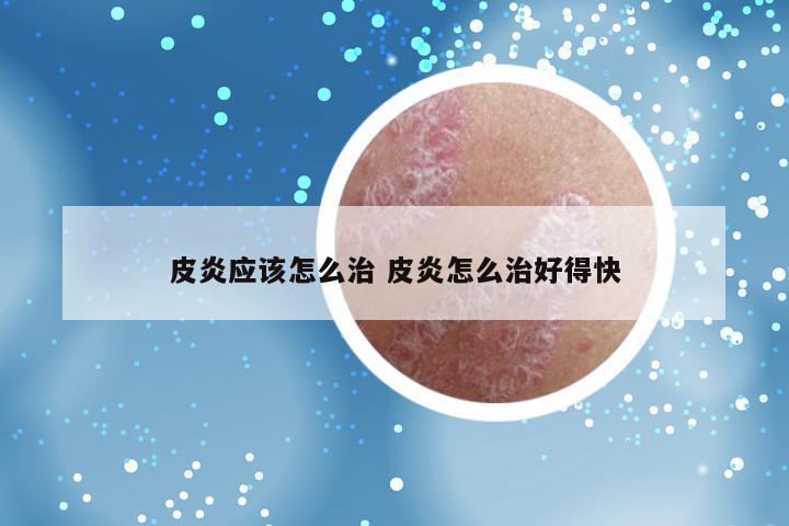 皮炎应该怎么治 皮炎怎么治好得快