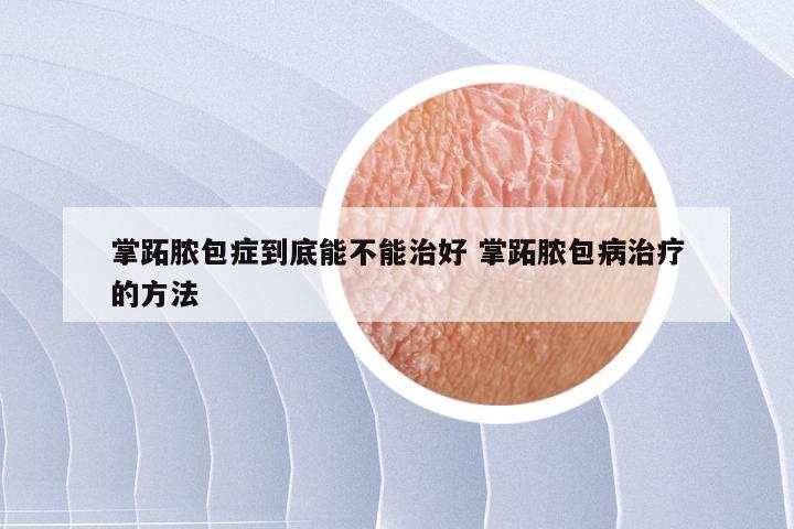 掌跖脓包症到底能不能治好 掌跖脓包病治疗的方法