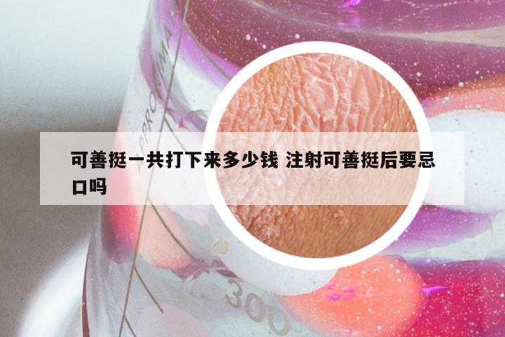 可善挺一共打下来多少钱 注射可善挺后要忌口吗