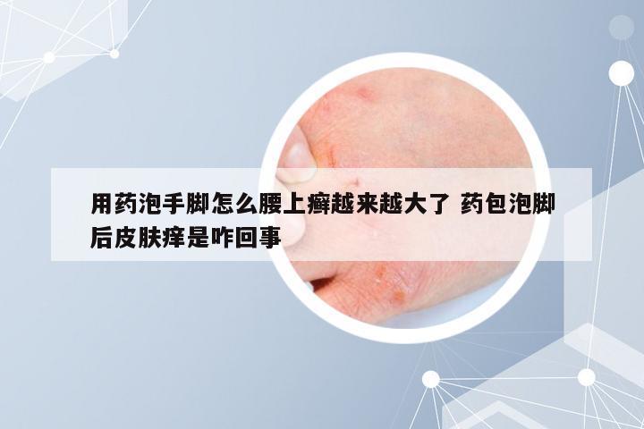 用药泡手脚怎么腰上癣越来越大了 药包泡脚后皮肤痒是咋回事