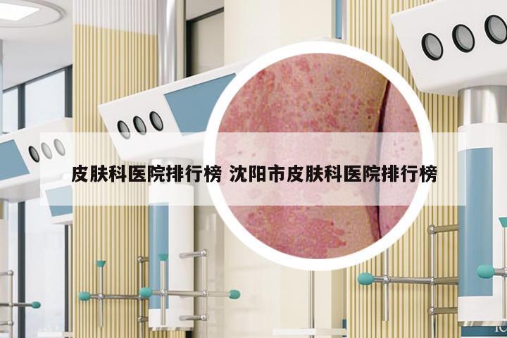 皮肤科医院排行榜 沈阳市皮肤科医院排行榜