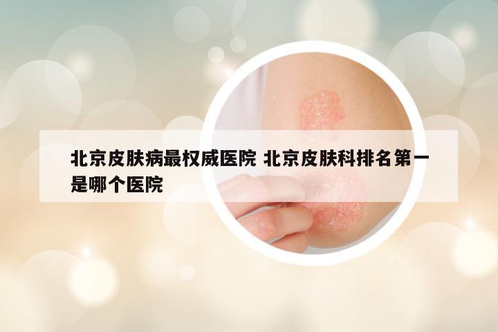 北京皮肤病最权威医院 北京皮肤科排名第一是哪个医院