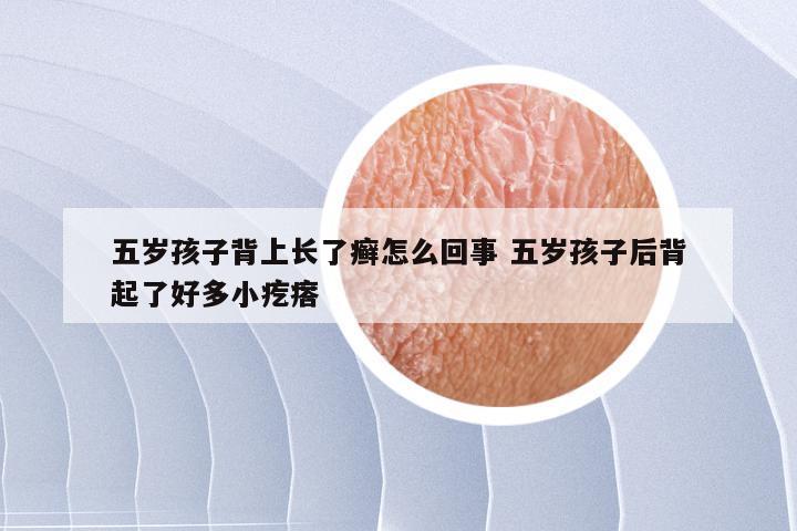 五岁孩子背上长了癣怎么回事 五岁孩子后背起了好多小疙瘩