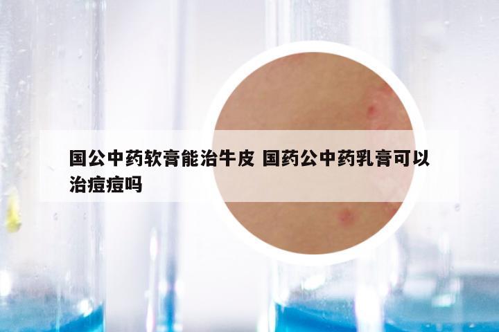 国公中药软膏能治牛皮 国药公中药乳膏可以治痘痘吗
