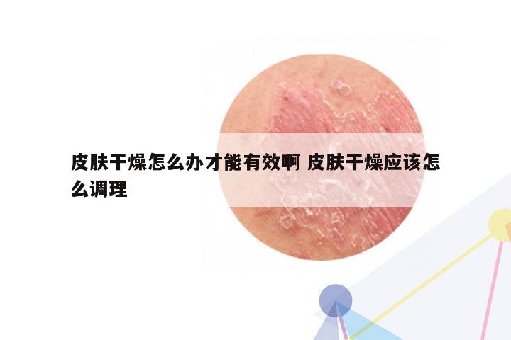 皮肤干燥怎么办才能有效啊 皮肤干燥应该怎么调理