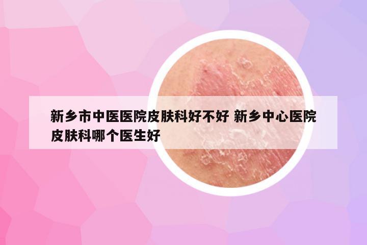 新乡市中医医院皮肤科好不好 新乡中心医院皮肤科哪个医生好