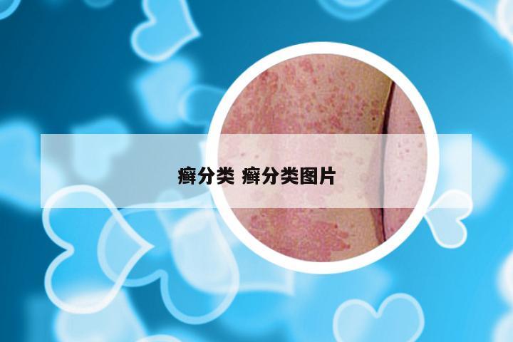 癣分类 癣分类图片