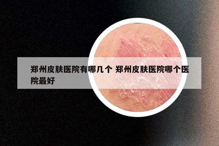 郑州皮肤医院有哪几个 郑州皮肤医院哪个医院最好